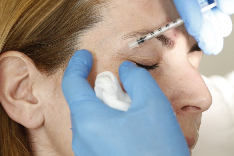 Una mujer recibe una inyección de botox.